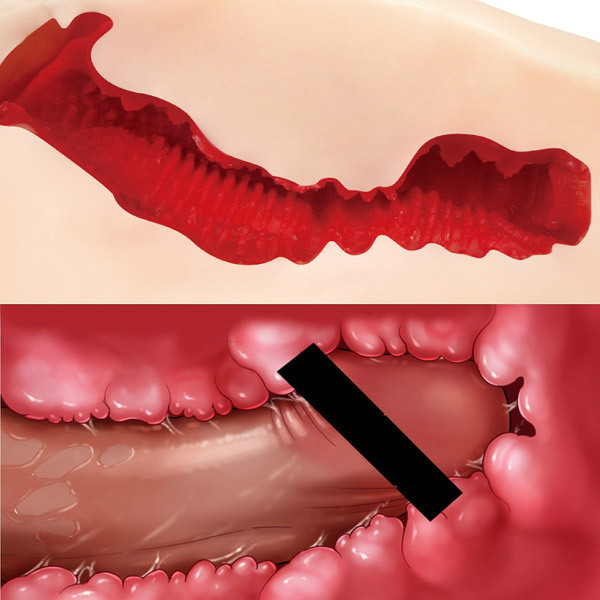 ���I�i������@�i�҂�����t�B�b�g�@�n�[�h�j