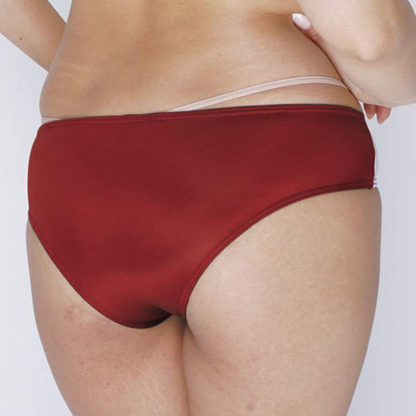 ����X�g���b�`�̑����@�u���}�@�G���W