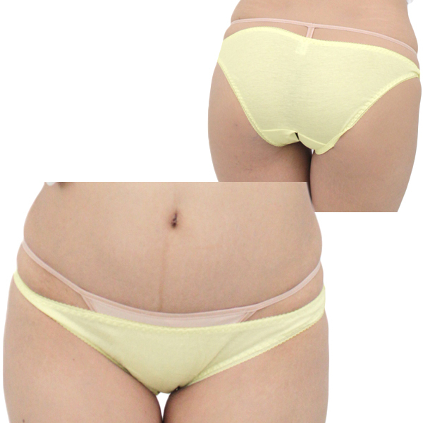 �L�k�����Q�R�b�g���ҊJ���t���o�b�N�@�C�G���[