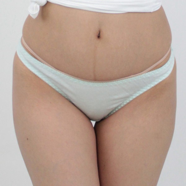 ���Ȃ��݂̗ǂ��R�b�g���V���v���t���o�b�N�k�@�T�b�N�X