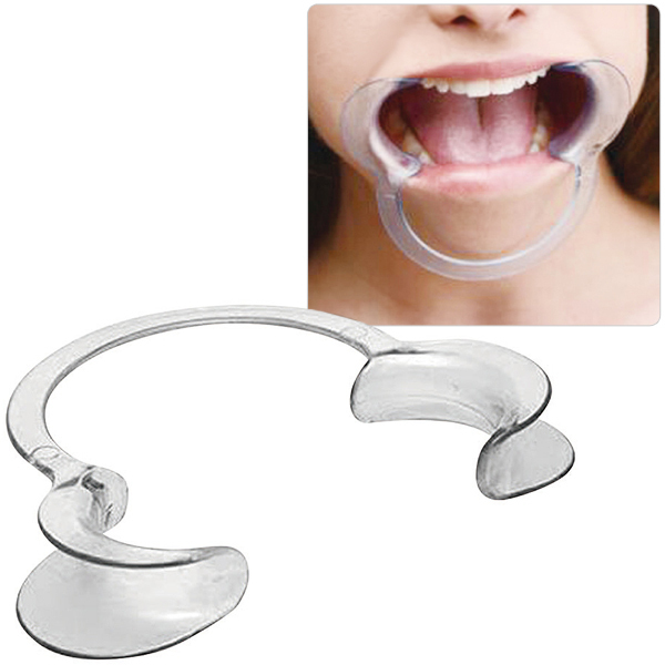 <SM VIP>マウスオープナー 10個セット